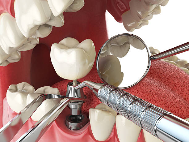 Best Urgent Dental Care for Toothache in Piedmont, SC